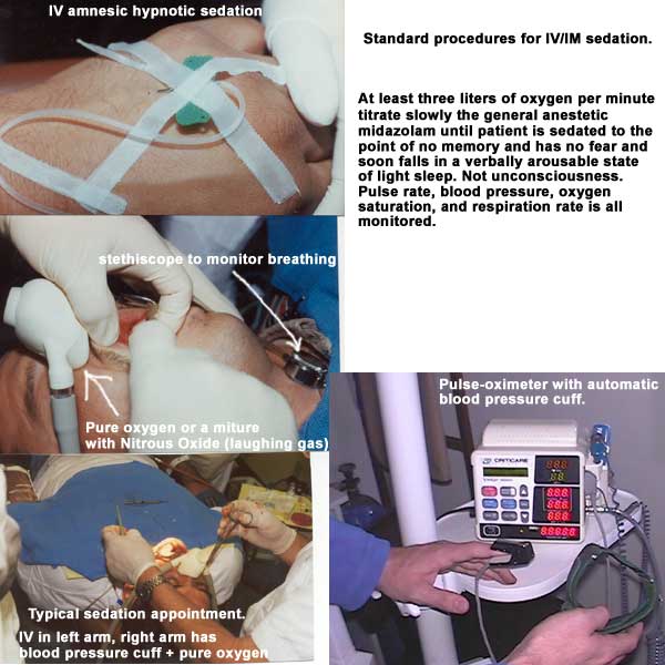 Standard procedural steps involved in IV/IM Sedation