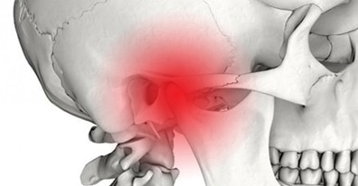 TMJ - Tempromandibular Joint