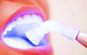 Teeth Whitening with purple light