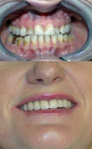 Large thumbnail for Cosmetic Dentistry. Carson & Carson, DDS.