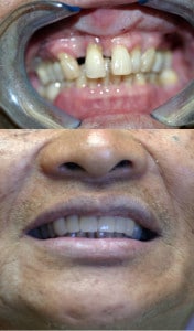 Miniatura gigante de Odontología Estética