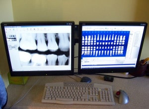 Our Digital X-ray setup at Carson & Carson, DDS